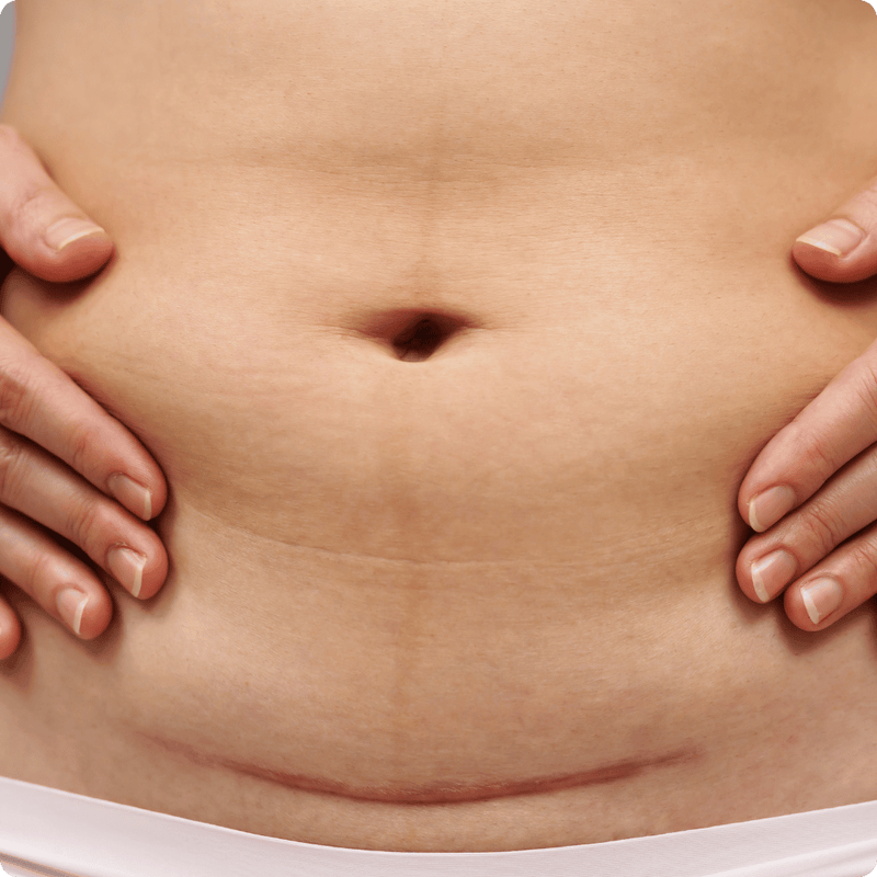 Tender days (recovery, pregnancy, postpartum)